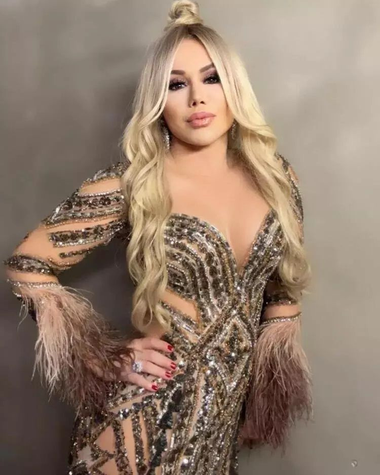 Estetiği bu kez fazla abarttı, görenler şaşkına döndü! İşte şarkıcı Ceylan'ın son hali - Sayfa 5