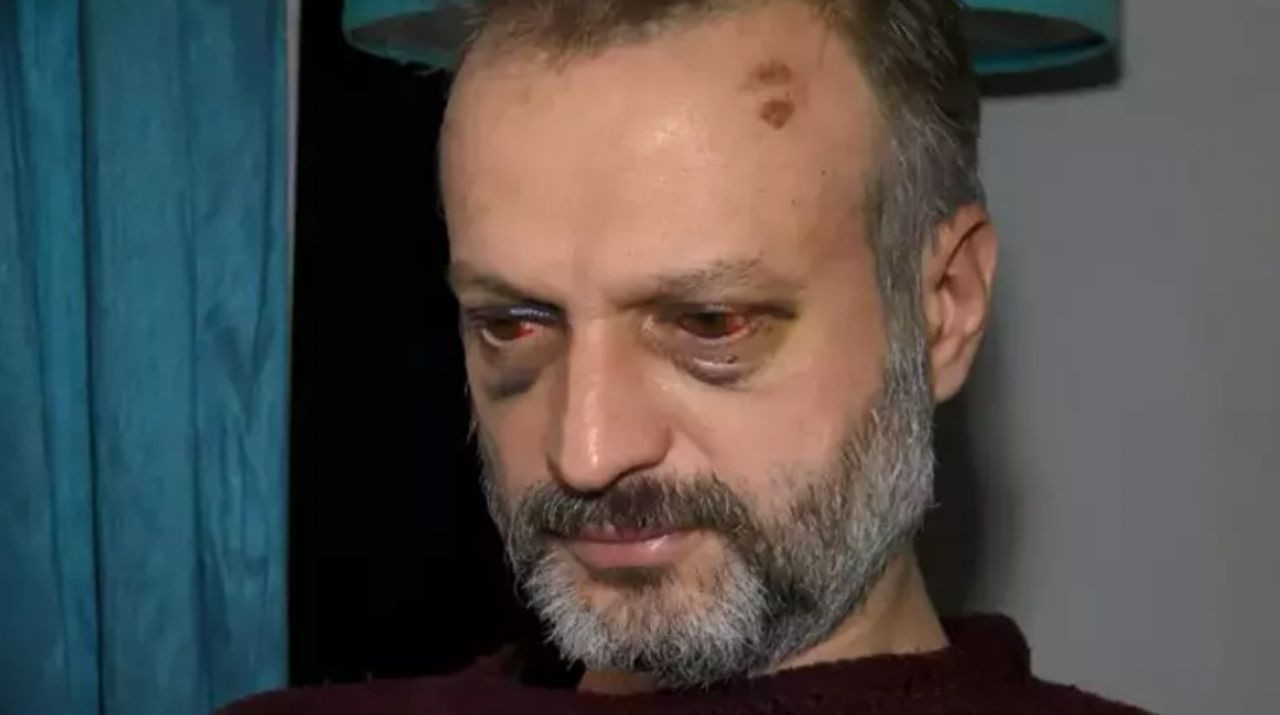 ‘Çiftetelli’ çalmadı diye öldüresiye dövdüler: "Hayvanca saldırdılar" - Sayfa 6