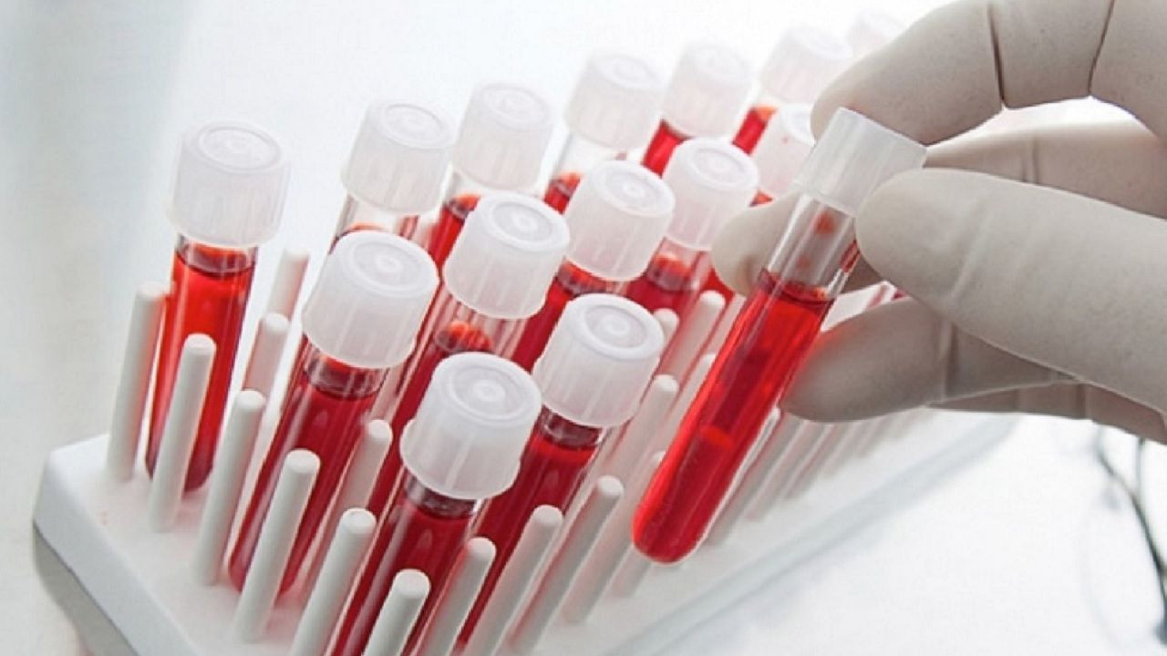 Japon bilimciler açıkladı! O kan grubuna sahip olanlar zeki oluyor... - Sayfa 5