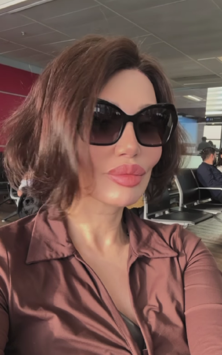 Alın daraltma ameliyatı olmuştu! İmaj değiştiren Umut Akyürek, Belgin Doruk'a benzetildi - Sayfa 5