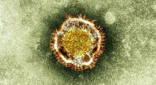 Çin, COVID-19 benzeri ölümcül bir virüsle laboratuvar deneyleri yapıyor - Sayfa 5