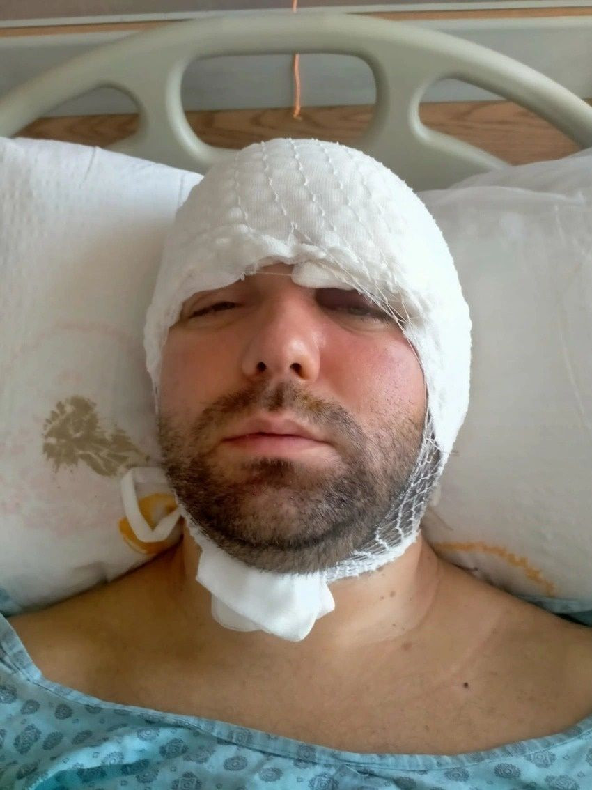 Bursa’da diş ameliyatında vahşet! Beynine vida saplandı - Sayfa 6