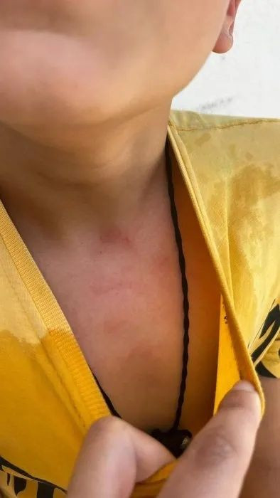 Karaman'da öğretmen dehşeti! Öğrencisini kaynar suyla haşlayıp başını duvara vurdu! - Sayfa 9