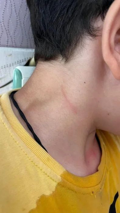 Karaman'da öğretmen dehşeti! Öğrencisini kaynar suyla haşlayıp başını duvara vurdu! - Sayfa 8