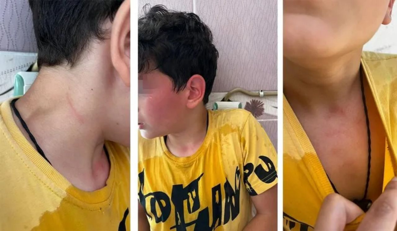 Karaman'da öğretmen dehşeti! Öğrencisini kaynar suyla haşlayıp başını duvara vurdu! - Sayfa 6