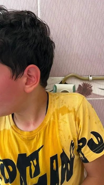 Karaman'da öğretmen dehşeti! Öğrencisini kaynar suyla haşlayıp başını duvara vurdu! - Sayfa 7