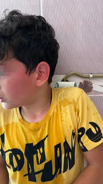 Karaman'da öğretmen dehşeti! Öğrencisini kaynar suyla haşlayıp başını duvara vurdu! - Sayfa 10