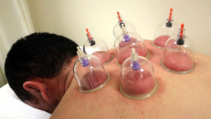 Aile hekimleri hacamat ve akupunktur yapacak! Yeni dönem başlıyor! Ücret detayı var... - Sayfa 5