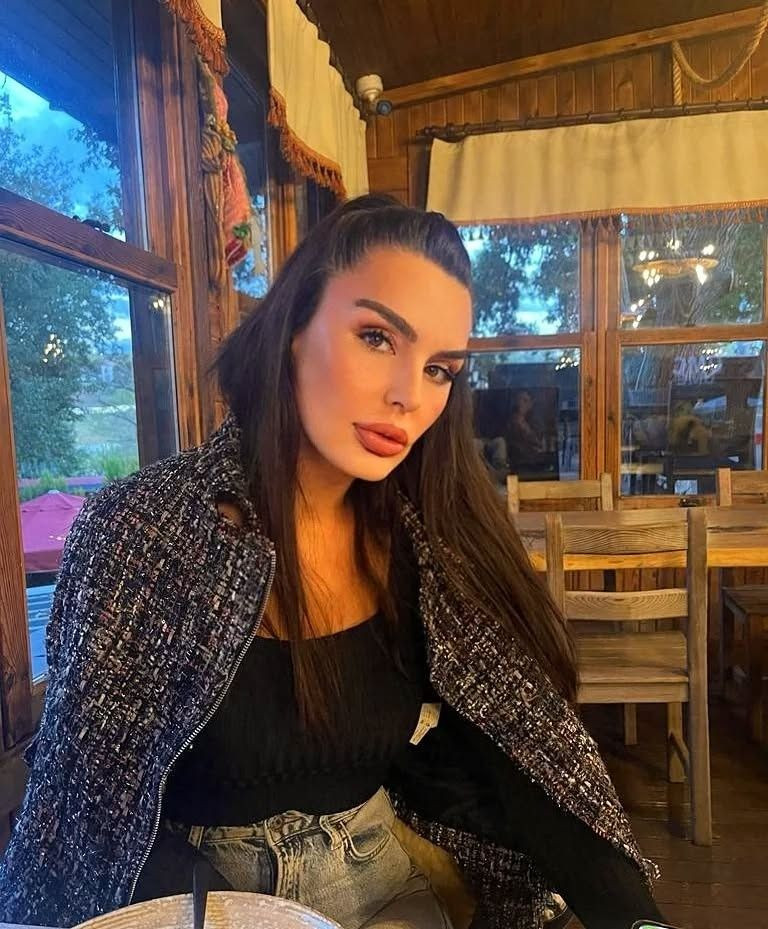 Eski manken Aysu Baçeoğlu, ''Hülya Avşar uyarmıştı'' diyerek sektör hakkında zehir zemberek sözler söyledi: Zamanında işim engellendi, kimse kimsenin ekmeğiyle oynamasın - Sayfa 4