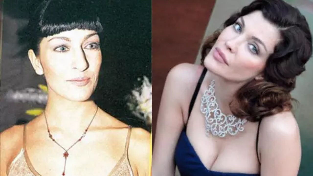 Ünlülerin yıllar içindeki değişimine inanamayacaksınız! Sanki yıllar geçmemiş gibi! İşte ünlülerin estetikli halleri... - Sayfa 7