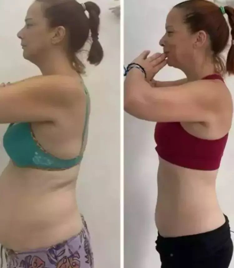 Yarım Elma’nın Yonca'sıydı! Janset Paçal’dan büyük değişim: 1,5 ayda 10 kilo verip imaj değiştirdi - Sayfa 4