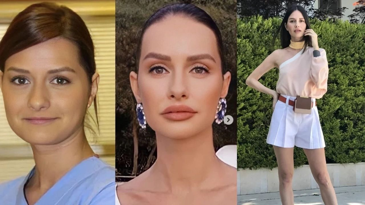 Yasemin Özilhan'dan estetik itirafı: "Sadece dudağımda dolgu var!" - Sayfa 2