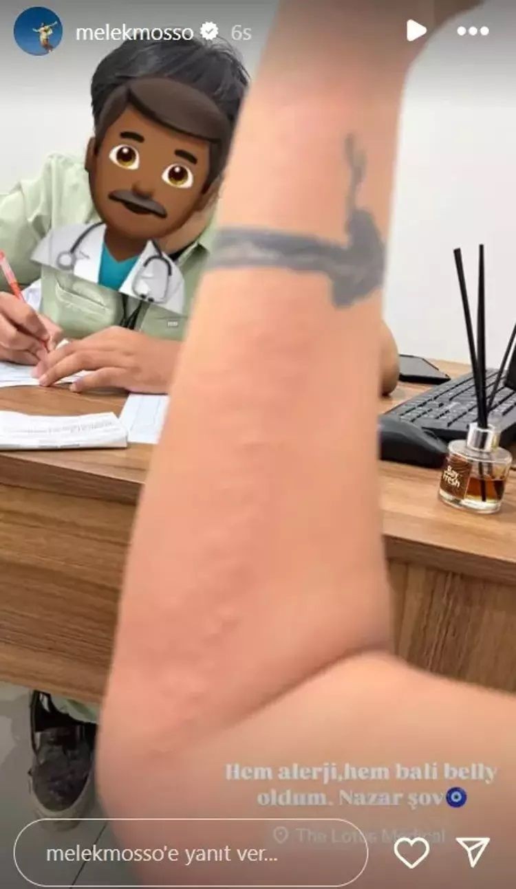Melek Mosso’nun Bali tatili kabusa döndü: Hastanelik oldu, görüntüler korkuttu! - Sayfa 4