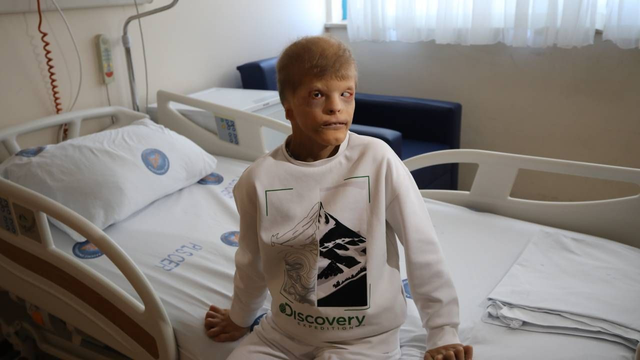 Savaş mağduru Ukraynalı çocuk milyonda 1 görülen hastalıkla doğdu, Türkiye'de şifa buldu - Sayfa 1