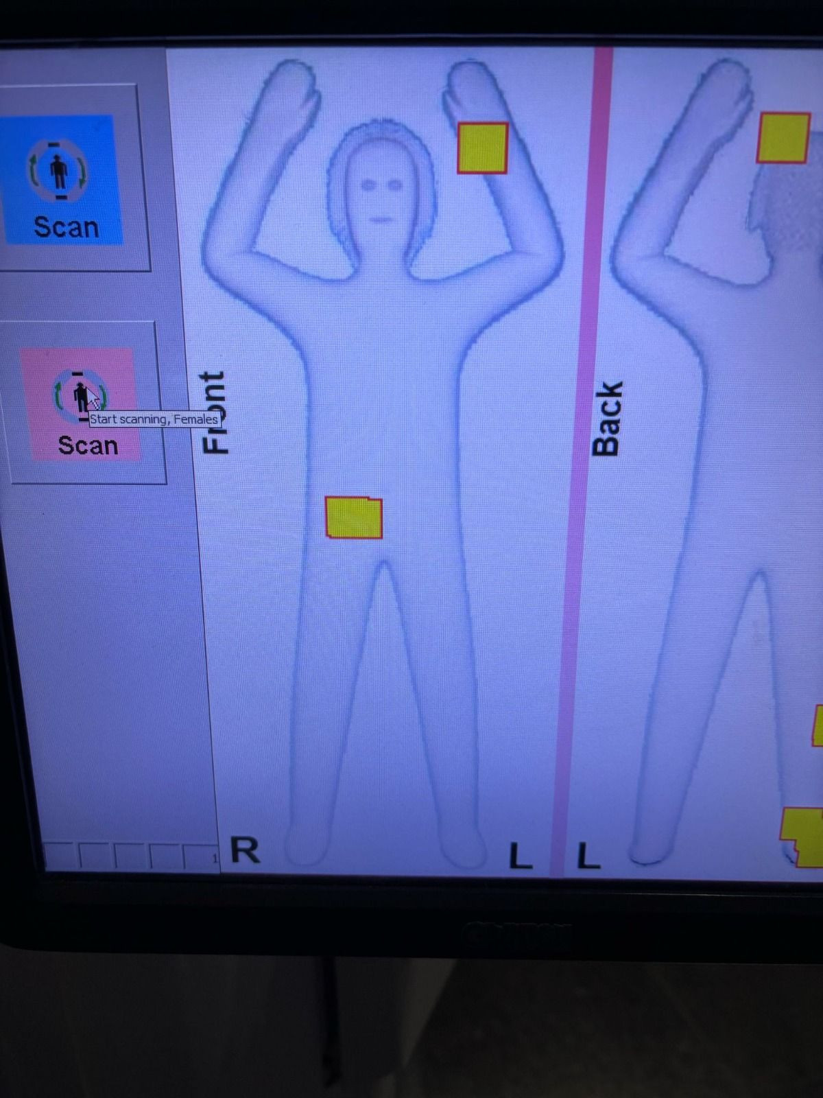 İstanbul Havalimanı’nda inanılmaz olay: 3 kadın 6 kilo altını cinsel organlarında saklamış! - Sayfa 8