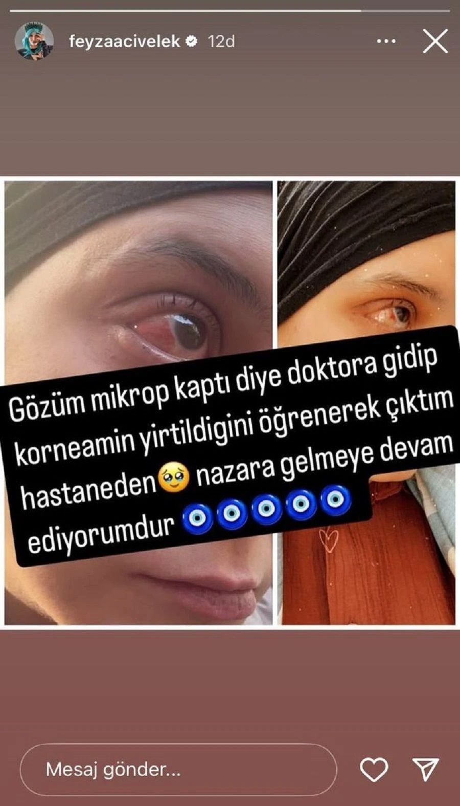 Gözüne kan gelen Feyza Civelek, doktora gidince gerçeği öğrendi! - Sayfa 3