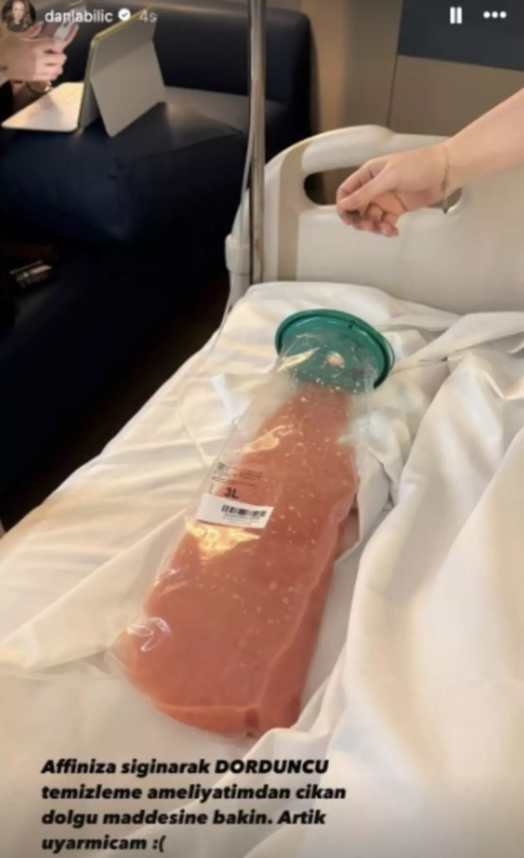 ''Kalça dolgum kaburgalarıma kadar çıktı'' diyerek Bülent Cihantimur'u suçlamıştı! 4. kez ameliyat olan Danla Bilic kalçasından çıkan dolgu maddesini yayınladı! Görenler çok şaşırdı - Sayfa 6