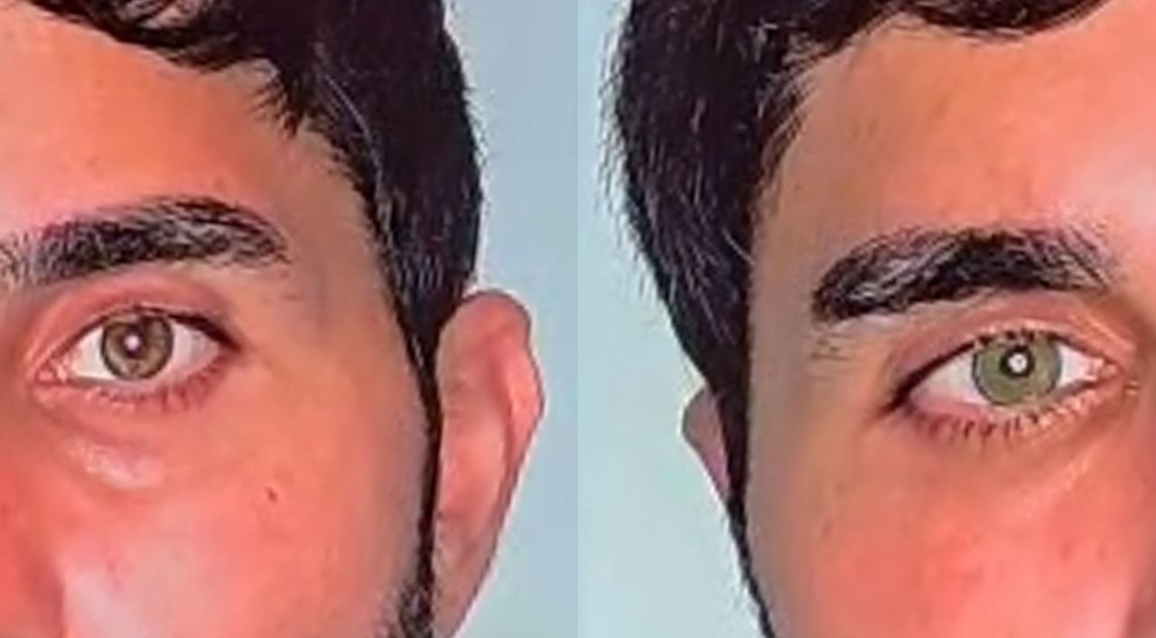 Göz rengini kalıcı olarak değiştirmek moda oldu! Yeşil ve maviye talep çok - Sayfa 1