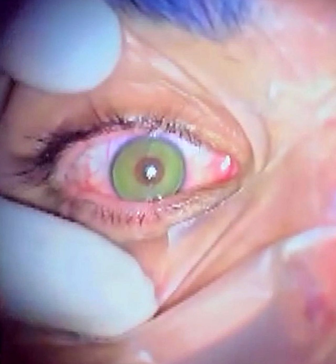 Göz rengini kalıcı olarak değiştirmek moda oldu! Yeşil ve maviye talep çok - Sayfa 2