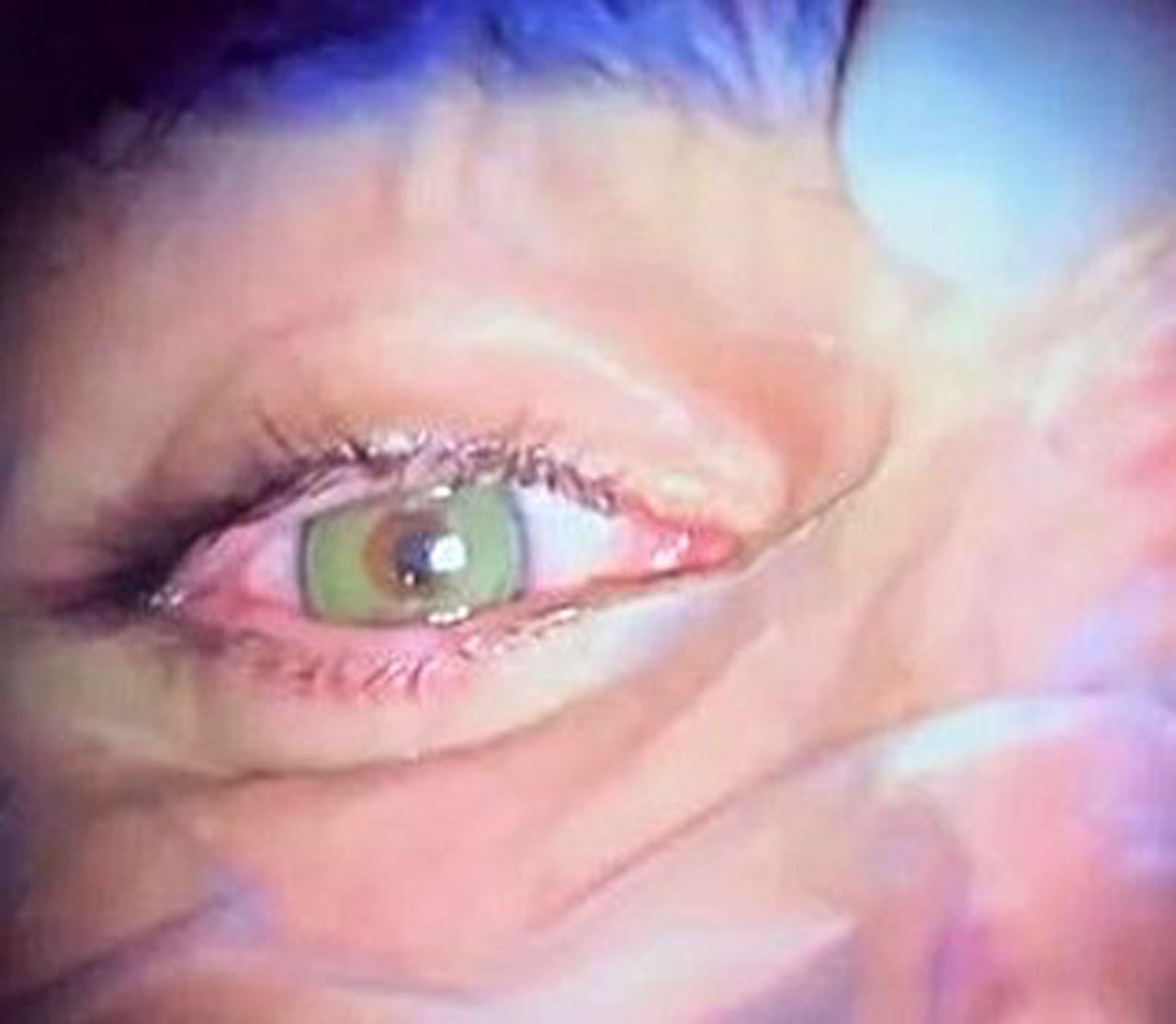 Göz rengini kalıcı olarak değiştirmek moda oldu! Yeşil ve maviye talep çok - Sayfa 3