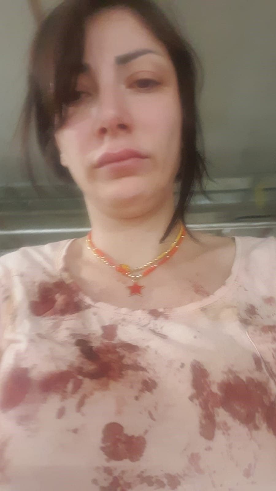 Bursa'da kangal dehşeti! Köpeğini gezdiren kadın paramparça ettiler; o anlar kamerada - Sayfa 5