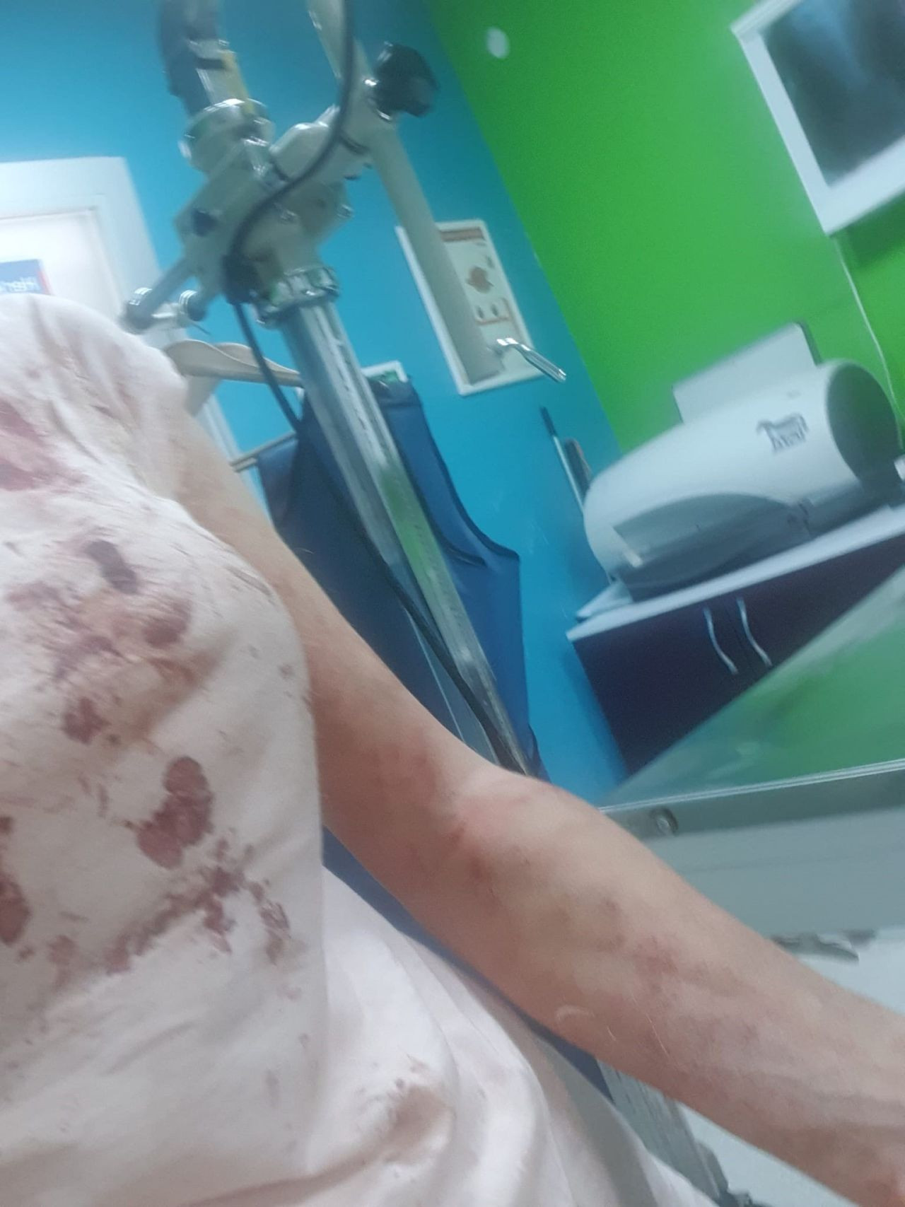 Bursa'da kangal dehşeti! Köpeğini gezdiren kadın paramparça ettiler; o anlar kamerada - Sayfa 3