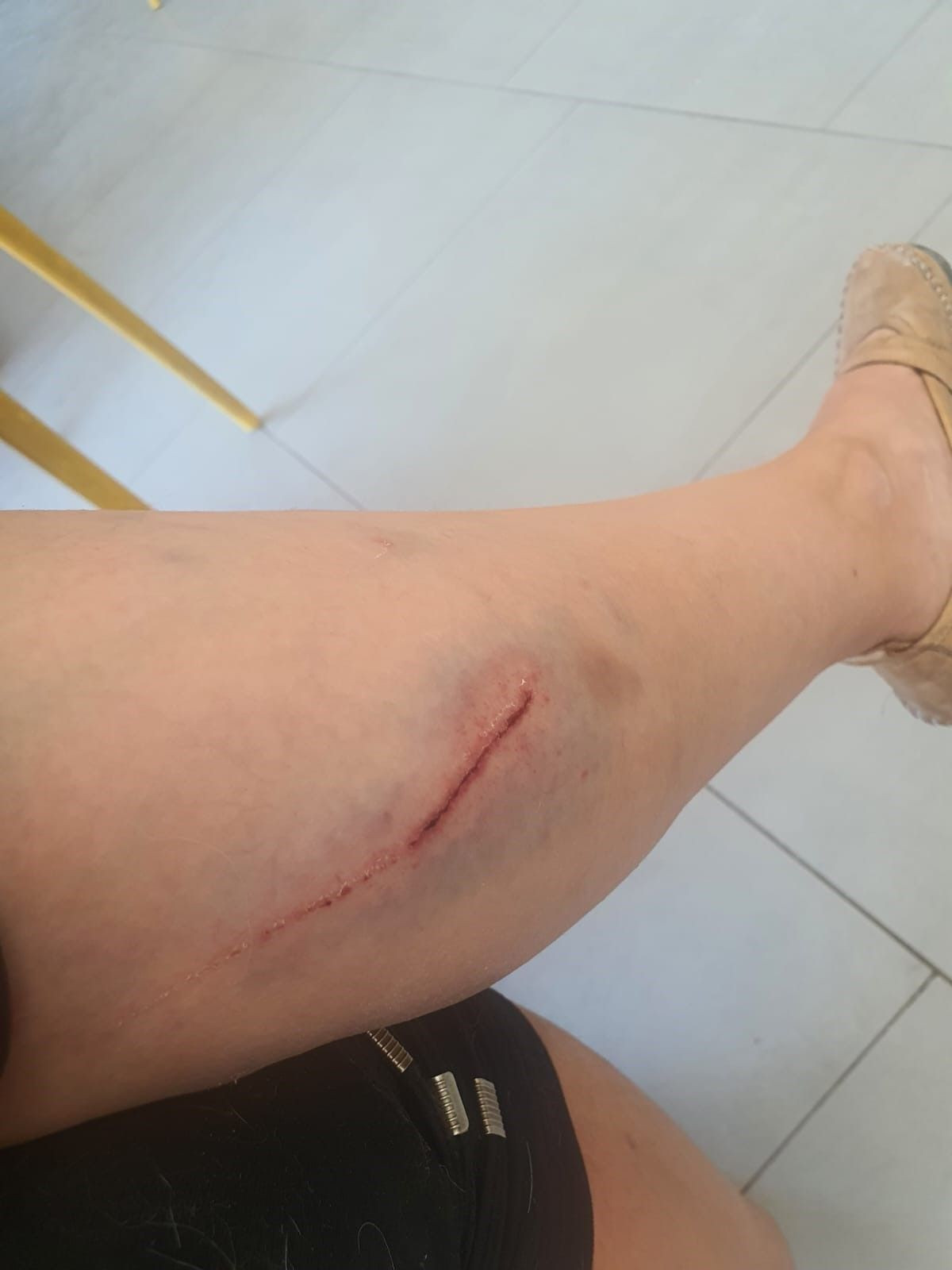 Bursa'da kangal dehşeti! Köpeğini gezdiren kadın paramparça ettiler; o anlar kamerada - Sayfa 2