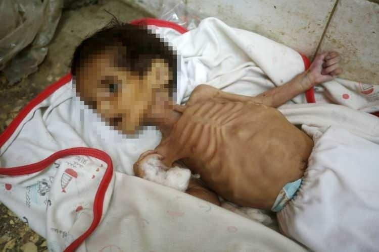 Yürekleri yakan haber! Gazze'de 3 aylık Curi bebek açlıktan öldü! - Sayfa 3