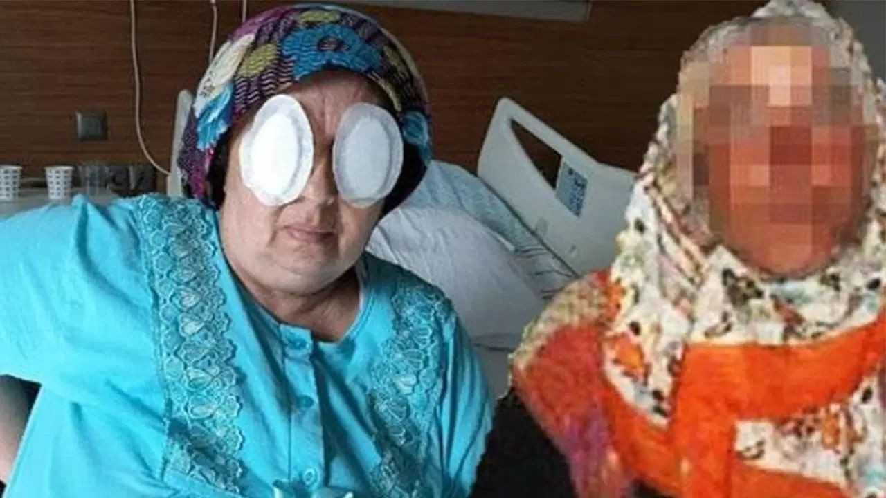 Kütahya'daki bakım merkezinde dehşet: Şizofreni hastası kadın, yatağa bağımlı hastanın iki gözünü oydu - Sayfa 2