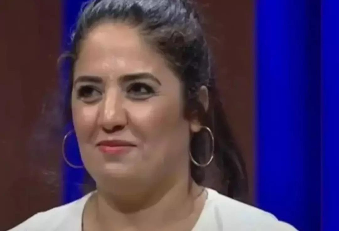 Azize Polat’ın MasterChef sonrası değişimi görenleri şaşırttı! Estetik operasyonlarla bambaşka biri oldu - Sayfa 2