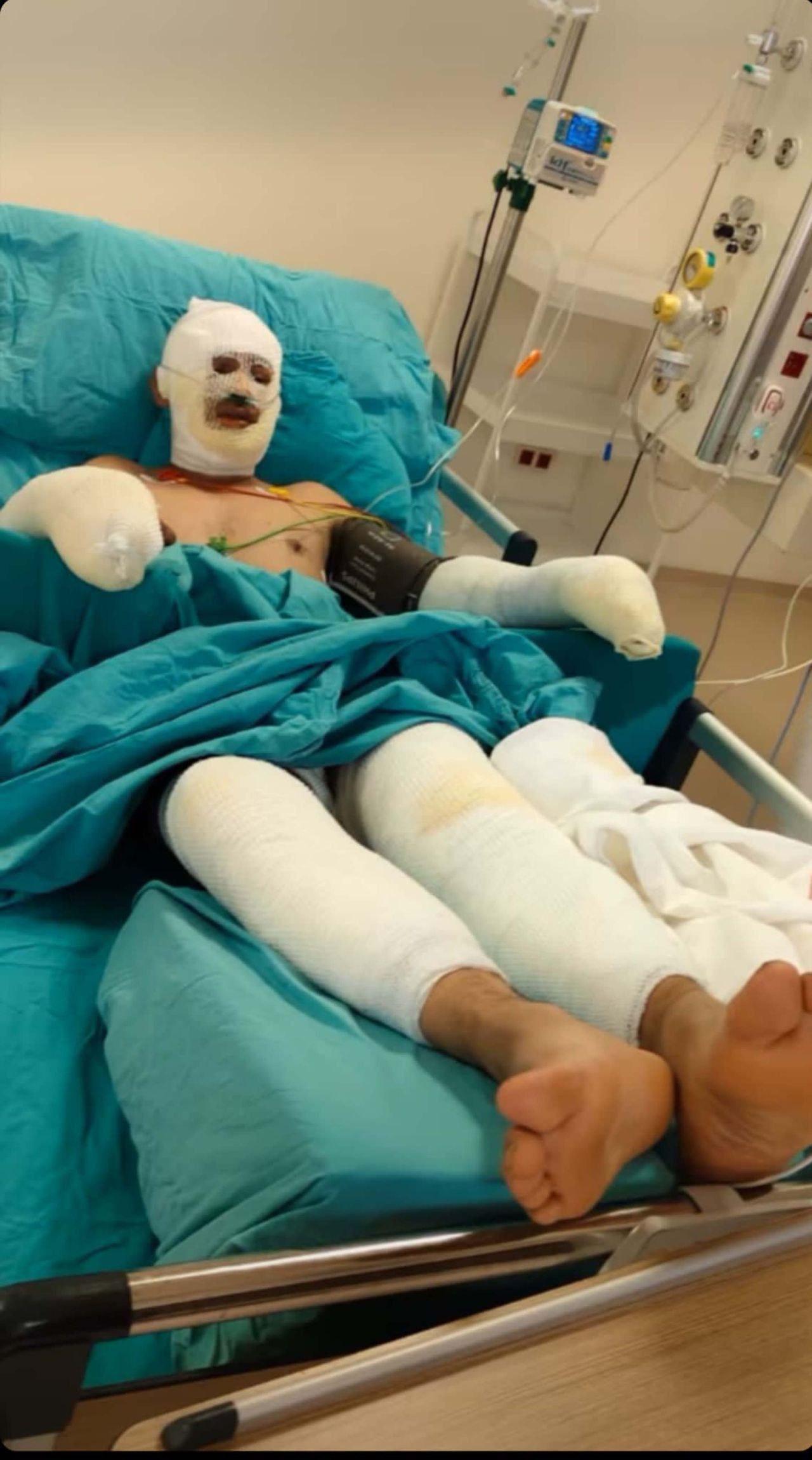 Seyitgazi yangınında ağır yaralanan kahraman ormancı Kader Dereli'nin son halini eşi paylaştı - Sayfa 6