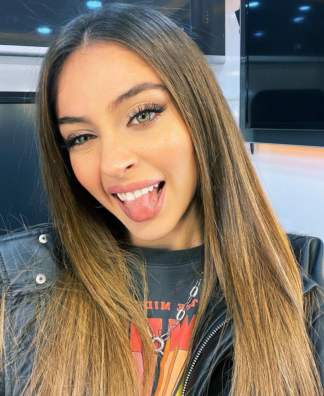 Cemre Baysel, ameliyat oldu! İşte son sağlık durumu - Sayfa 3