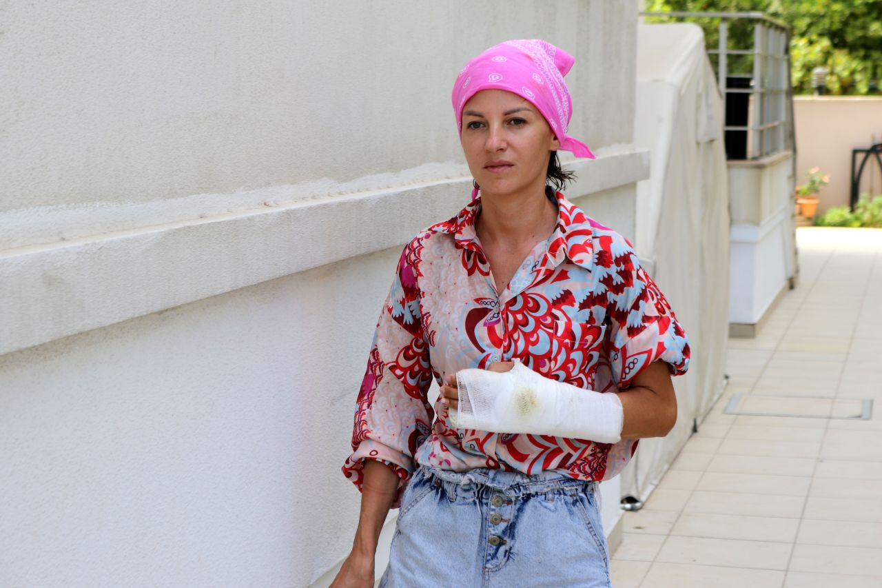 Ukraynalı eski eşi Irina'ya sopayla saldırdı, hastanelik etti! "Öldüreceğim" diyerek defalarca vurdu - Sayfa 1