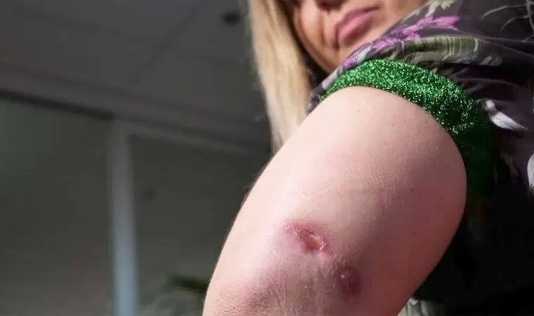 Et yiyen bakteri paniği! Sağlık Bakanlığı’ndan ‘Vibrio’ açıklaması: Türkiye’de vaka tespit edilmedi - Sayfa 4