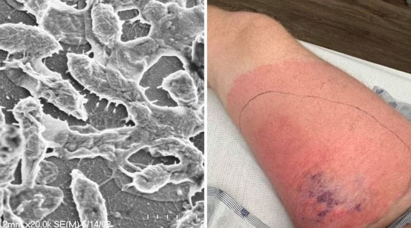 Et yiyen bakteri paniği! Sağlık Bakanlığı’ndan ‘Vibrio’ açıklaması: Türkiye’de vaka tespit edilmedi - Sayfa 3