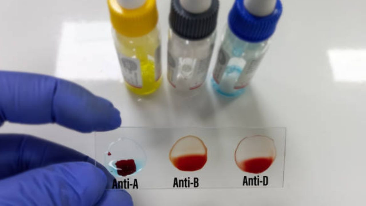 En zeki insanların çıktığı kan grubu; Türkiye’de çoğunluk bu kan grubunda yer alıyor. - Sayfa 4