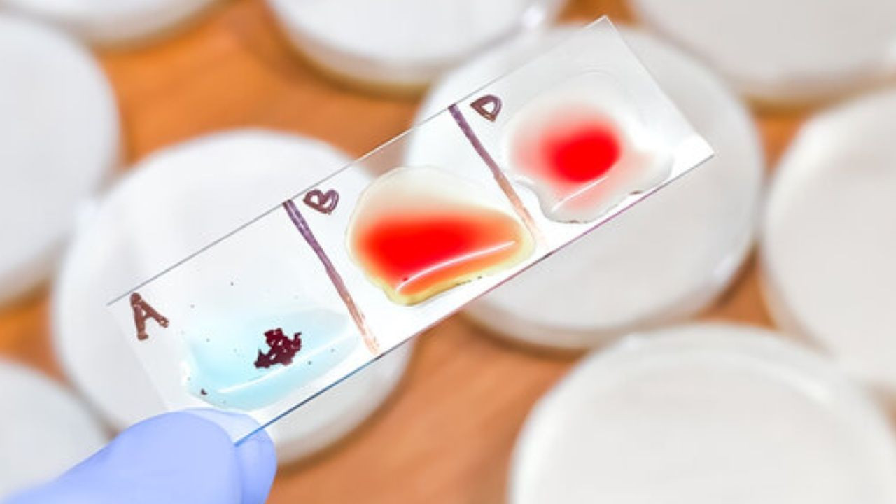 En zeki insanların çıktığı kan grubu; Türkiye’de çoğunluk bu kan grubunda yer alıyor. - Sayfa 5