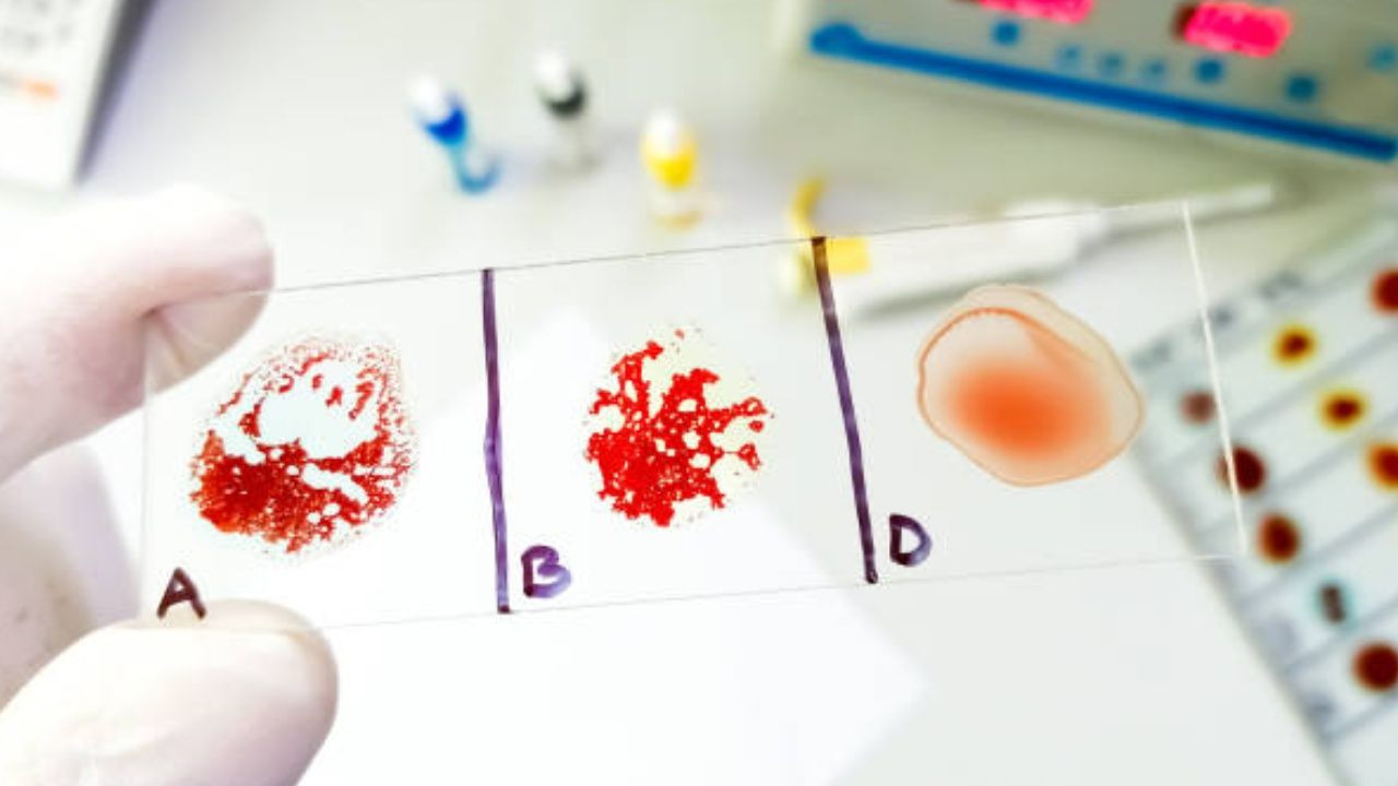 En zeki insanların çıktığı kan grubu; Türkiye’de çoğunluk bu kan grubunda yer alıyor. - Sayfa 6