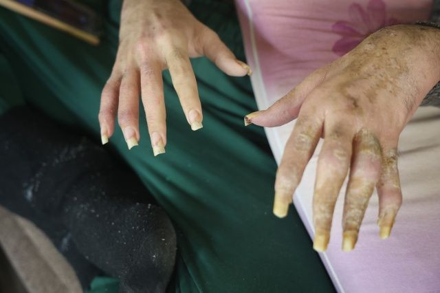 3 yıldır evden çıkmayan, banyo yapmayan Barış Özbay'ın eski hali ortaya çıktı... "Eskiden çok bakımlıydı..." - Sayfa 4