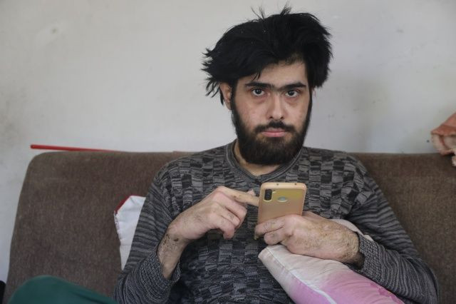 3 yıldır evden çıkmayan, banyo yapmayan Barış Özbay'ın eski hali ortaya çıktı... "Eskiden çok bakımlıydı..." - Sayfa 1