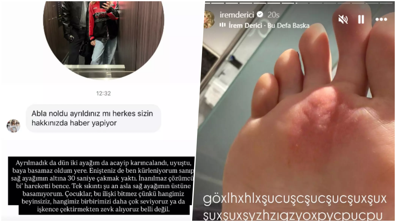 İrem Derici sevgilisinden ayrıldı mı? 'Ayağımın altına çakmak yaktı' deyip fotoğrafını paylaştı - Sayfa 4