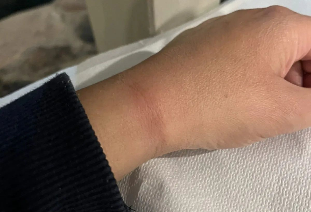 Midilli’de Türk turist çifte şok: Sigara yüzünde nezarette soğukta bırakıldılar, yemek verilmedi! - Sayfa 5