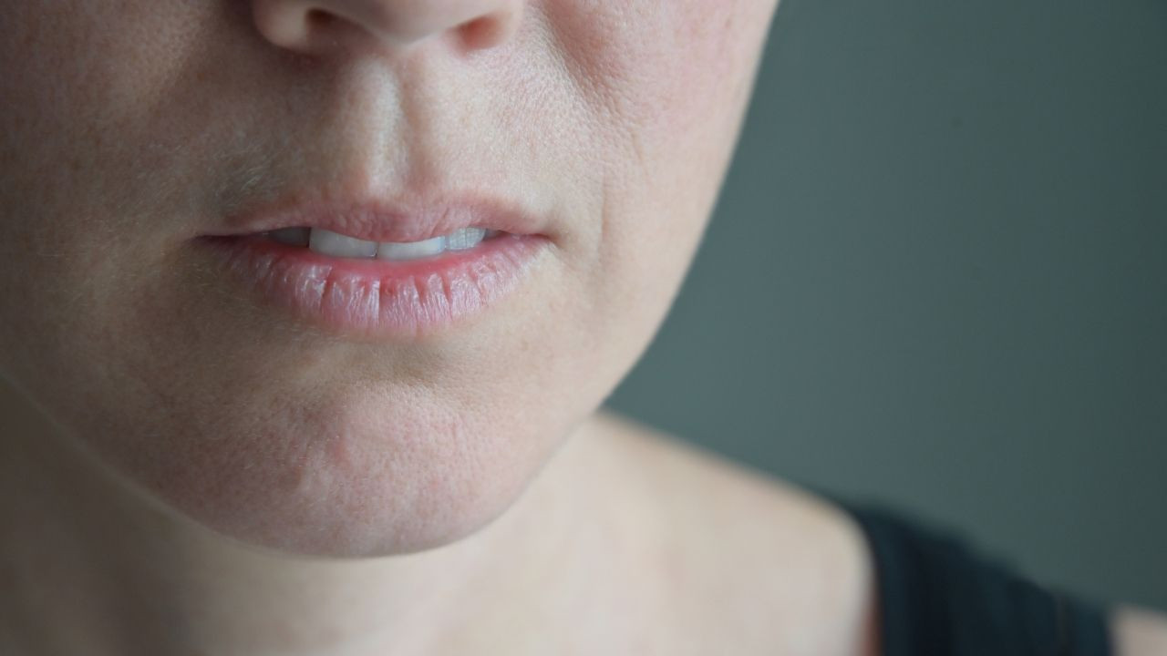 Ağız kuruluğunu hafife almayın: Sjögren Sendromu'nda erken tanı kritik