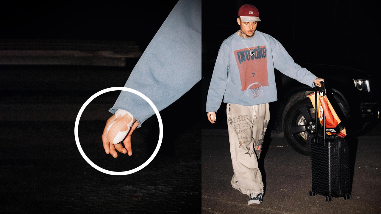 Noa Lang'ın parmağının son durumu