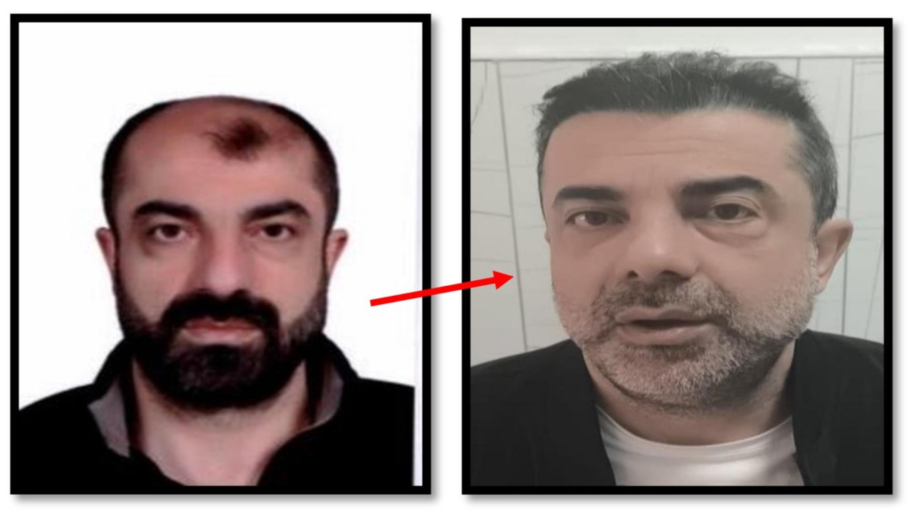 BİR GARİP OLAY! Ankara'da cinayet azmettiricisi, ameliyatla yüzünü değiştirdi! Yine de polisten kaçamadı...