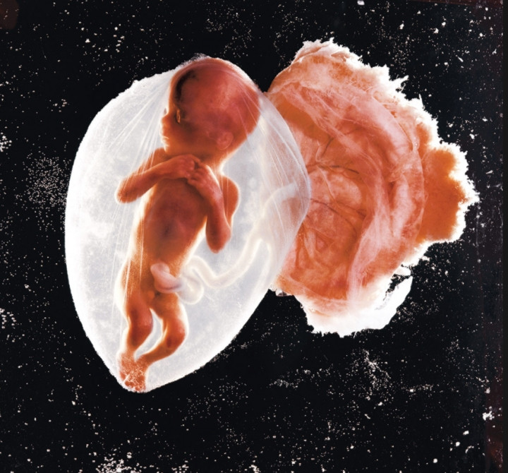 Time yüzyılın fotoğraflarını seçti! Türkiye de listede... - Sayfa 38