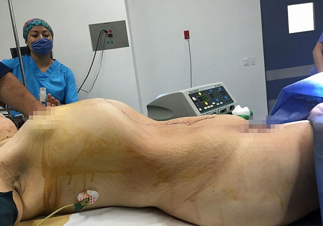 Göbek zannetti ama içinden çıkan şoke etti - Sayfa 6