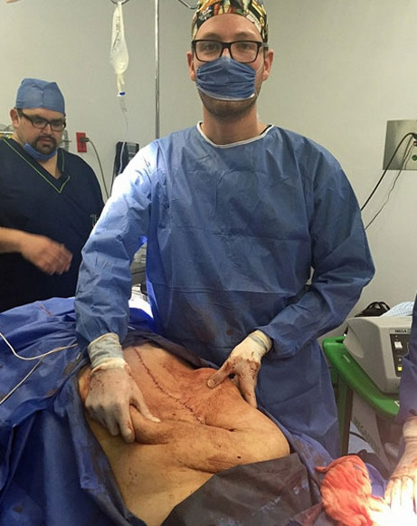 Göbek zannetti ama içinden çıkan şoke etti - Sayfa 8