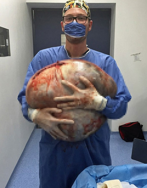 Göbek zannetti ama içinden çıkan şoke etti - Sayfa 5