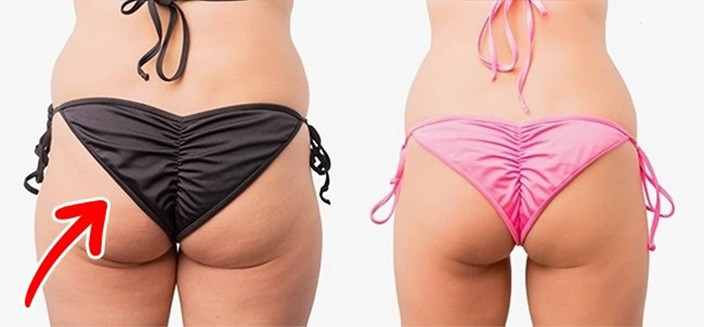 Günde iki yumurta yiyince vücudumuzda oluşan 9 efsane değişim - Sayfa 6